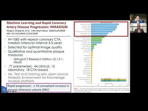 Sponsored webinar | Advanced Plaque Analysis and Next-generation FFRCT: A Case-Based Discussion