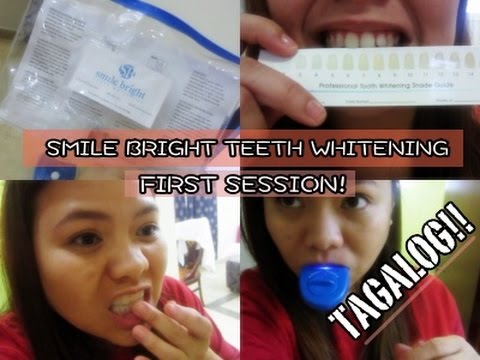 SMILE BRIGHT TEETH WHITENING (FIRST SESSION) l LittleMsEms