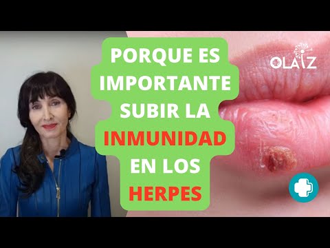 HERPES: Cuando Aparece es Importante que...