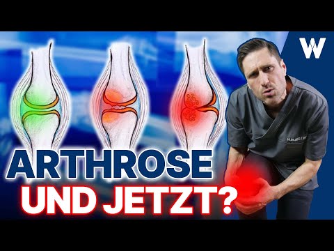 Arthrose: Machen Sie nicht die typischen Fehler - Es sind Ihre Gelenke! Ursachen, Symptome, Therapie