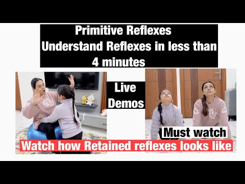 6 Most Common Retained Primitive Reflexes | Assessment of primitive Reflexes at home  | Autism