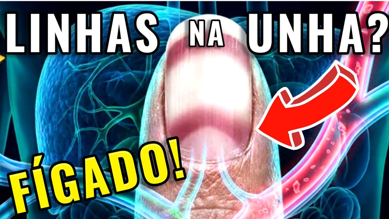 7 Sinais Silenciosos de Fígado Doente que Você Provavelmente Ignora nas suas Unhas