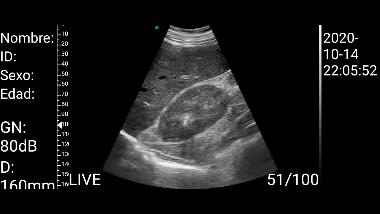 C10RLdouble wifi&USB 3 in 1 probe-convex probe for abdomen