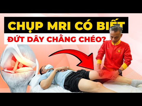 Đứt Dây Chằng Chéo: Chụp MRI Có Phát Hiện Được? - Bác Sĩ Thể Thao Giải Đáp