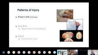 Preterm Birth Struggles &amp; Physician Interventions