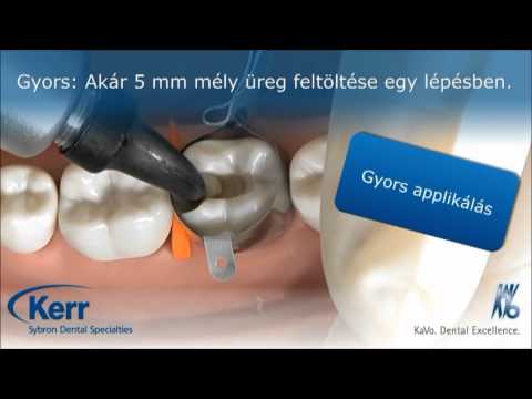 SonicFill - kompozit tömési rendszer