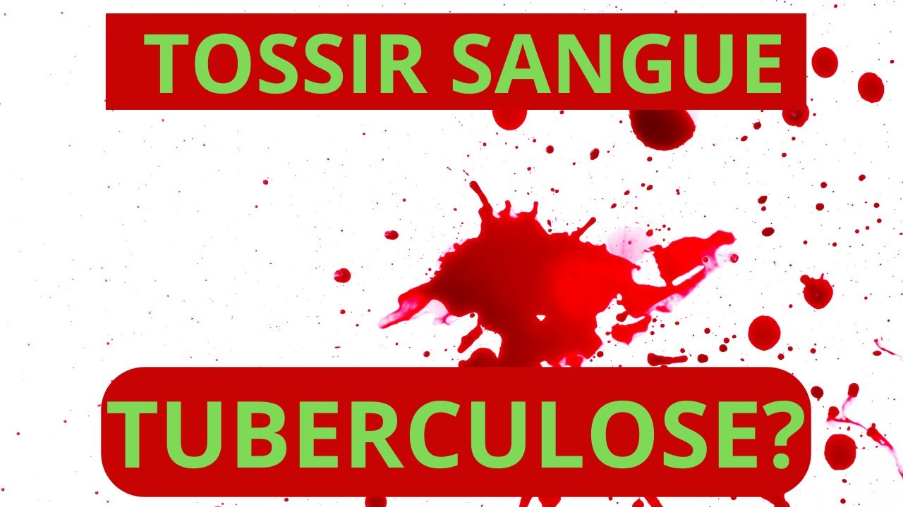 SINTOMAS da TUBERCULOSE - Se você tem esses sintomas...