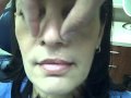 Plastic Surgeon Dr. JEFFREY EPSTEIN - Female Patient.