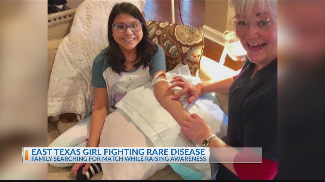 Emi's awareness for dock8