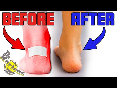 The Secret to Breaking In Your Dr. Martens Without Pain