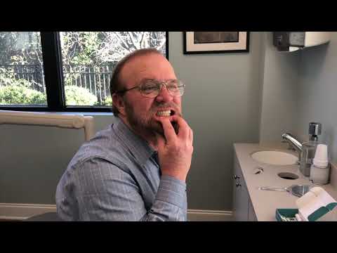 Easy Denture™ Patient Self Fitting Maxillary and Mandibular