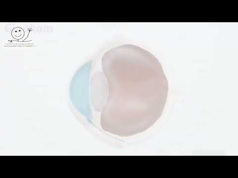 Glaukom (Grüner Star) kindgerecht erklärt