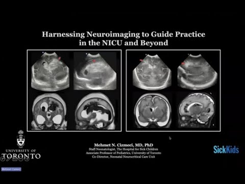 Harnessing Neuroimaging To Guide Practice in the NICU...