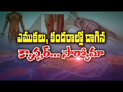 Dr. Madhav Danthala explains bone and soft tissue sarcoma on ETV Sukhibhava