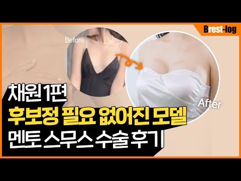 [채원] 가슴성형 브이로그 1편 I 가슴성형 당일 통증과 수술 시간은? I 완전 솔직한 찐리뷰 갑니다 | 윈느성형외과 라벨윈느 유튜브 영상