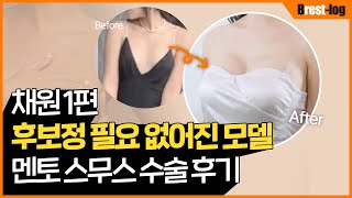 [Chaewon] 隆胸 Vlog 第1集 — 手术当天疼痛与手术时间真实分享 | UNE 整形外科 — La Belle Une 视频频道