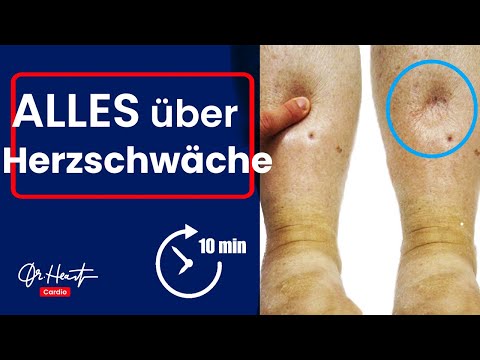 Alles über Herzschwäche (Herzinsuffizienz) - in 9 Minuten! | Dr. Heart