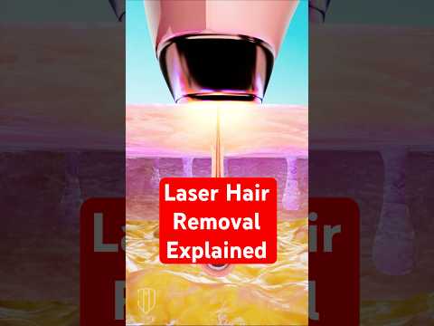 How Laser Hair Removal Works #science #medical #dermatology #lifehacks #viralshorts