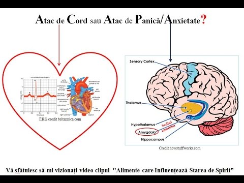 Test online pentru acuitatea vizuală