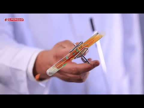 Chemistry - 3Sec - The detection of nitrate anion