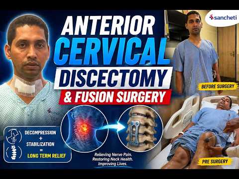 Patient Testimonials | Dr. Ajay Kothari - Minimally invasive endoscopic, scoliosis & Spine Surgeon | Shivaji Nagar, Pune