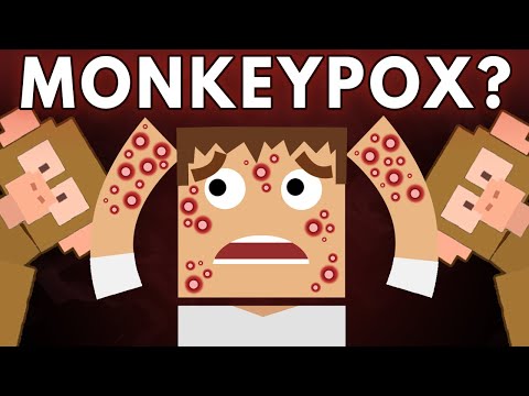 猴痘會對你的身體造成什麼影響？ (What Does Monkeypox Do To Your Body?)