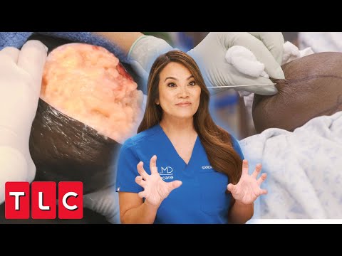 , title : 'Dr. Lee Removes a Gigantic Knob From Patient’s Butt! | Dr. Pimple Popper'