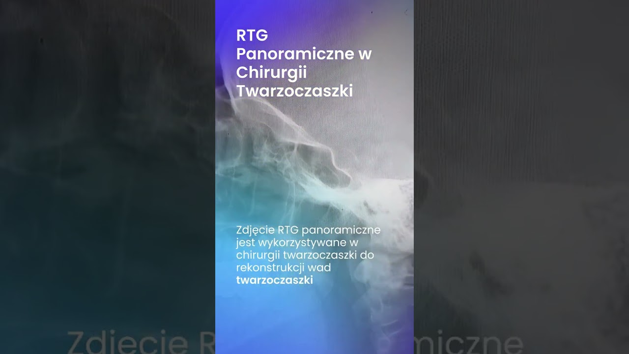 Grażyna Andruszkiewicz-85