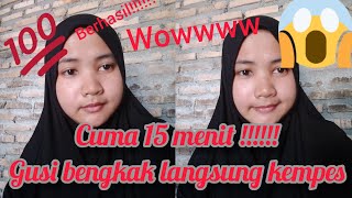 Download lagu cara mengempeskan gusi bengkak dengan cepat mp3 Download lagu cara mengempeskan gusi bengkak dengan cepat mp3