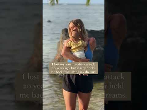 20 years ago I was attacked by a shark, and lost my arm..