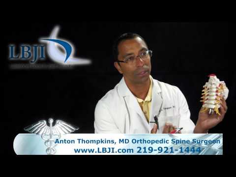 Dr. Anton Thompkins Explains Cervical Disc Replacement