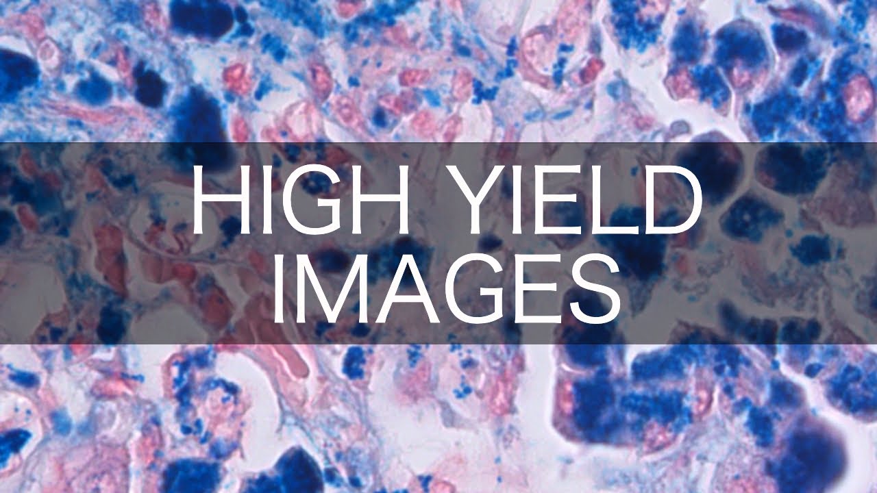 High Yield USMLE/COMLEX Images (pt. 4)