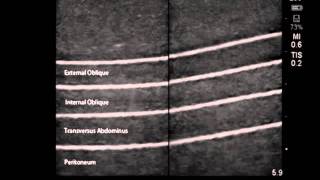 Product video: CAE Blue Phantom Central Line Ultrasound Training Models