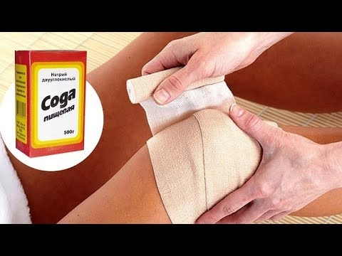Рецепт СОДОВОГО КОМПРЕССА для снятия ОТЁКОВ Фролова Ю.А. / Сода пищевая