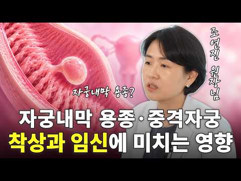 착상 실패와 유산 반복, 자궁내막 용종 vs 중격자궁 차이점 정리