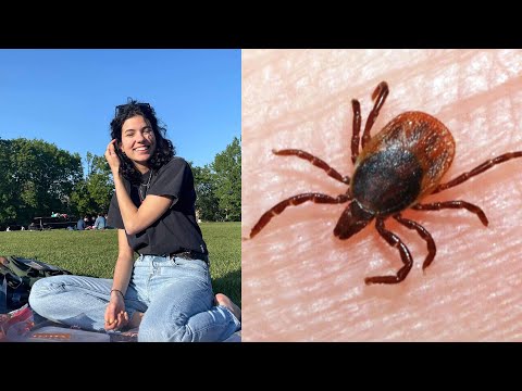 Quebec woman warning others about Lyme disease after late diagnosis | Tick safety