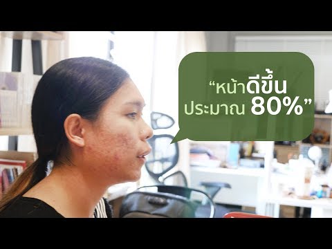 โรคสะเก็ดเงินและการวินิจฉัยแยกโรคสีชมพู โรคสะเก็ดเงินในรูปขาหนีบ