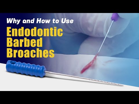 Why and How to use Endodontic Barbed Broaches | Waldent Short Barbed Broaches