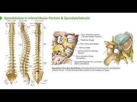 Anatomie I Bewegungssystem: Rücken (Knöcherne Strukturen) I Prof. Dr. med. Wirth