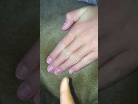 My dog Roxie’s pups move