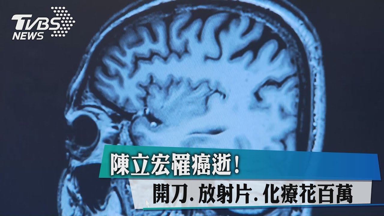 陳立宏罹癌去逝! 開刀+化療年花上百萬