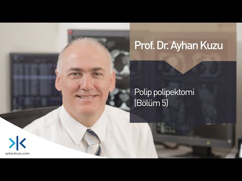 Polip polipektomi (Bölüm 5)