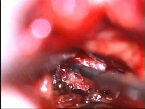 Ist Honig mit Rückenschmerzen Schmerzen in den Gelenken zwischen den Beinen während der Schwangerschaft