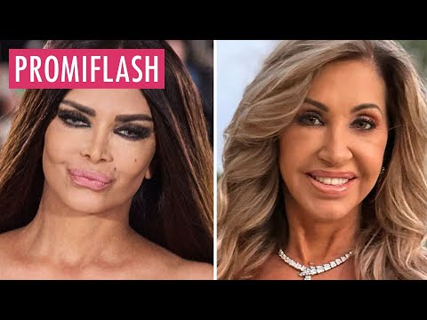 Expensive cosmetic surgery: Kader Loth attacks Carmen Geiss