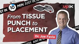 From Tissue Punch to Placement in 10 Minutes | Dr. Joe Favia
