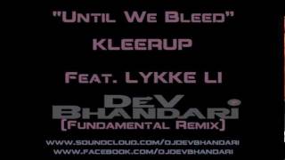 Until We Bleed - Kleerup Feat Lykke Li (DEV BHANDARI FUNDAMENTAL REMIX)
