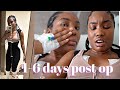 VLOG 1 6 Days POST OP LIPOSUCTION BREAST LIFT Ya Ll I M In PAIN