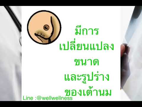 เสริมเต้านมฟรี กำลังมองหาผู้หญิงที่มีหน้าอกเล็ก