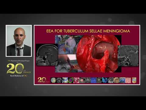 Minimally Invasive Cranial Tumor Neurosurgery in 2020
