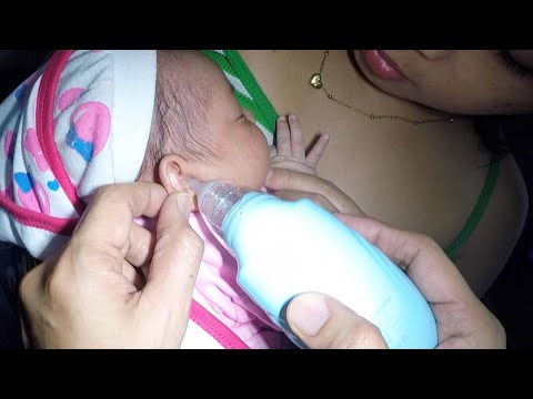 Removing Ear Fluids & Discharges from Baby's Infected Ear
